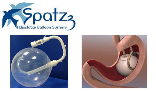 balón intragástrico balón intragástrico